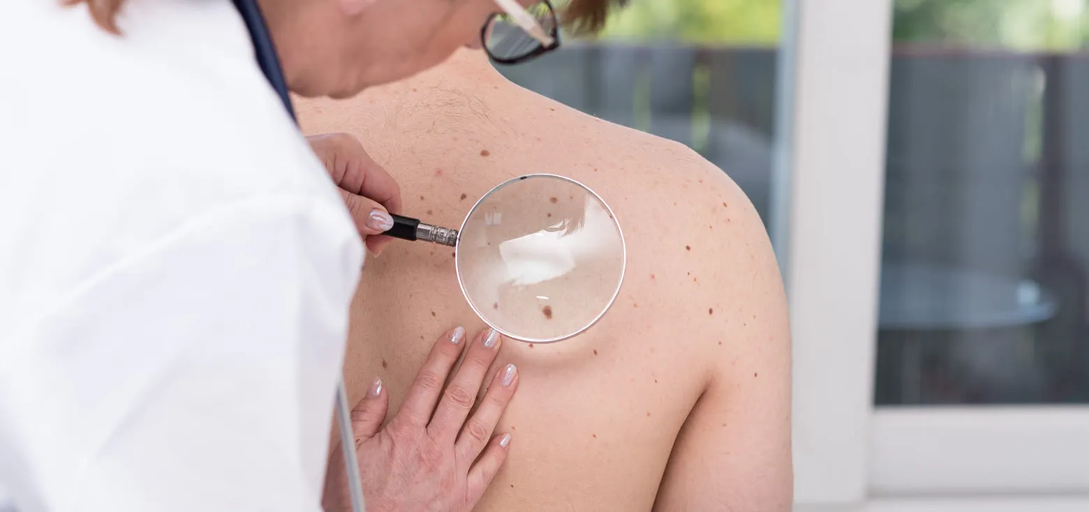 Full-Body Skin Exams