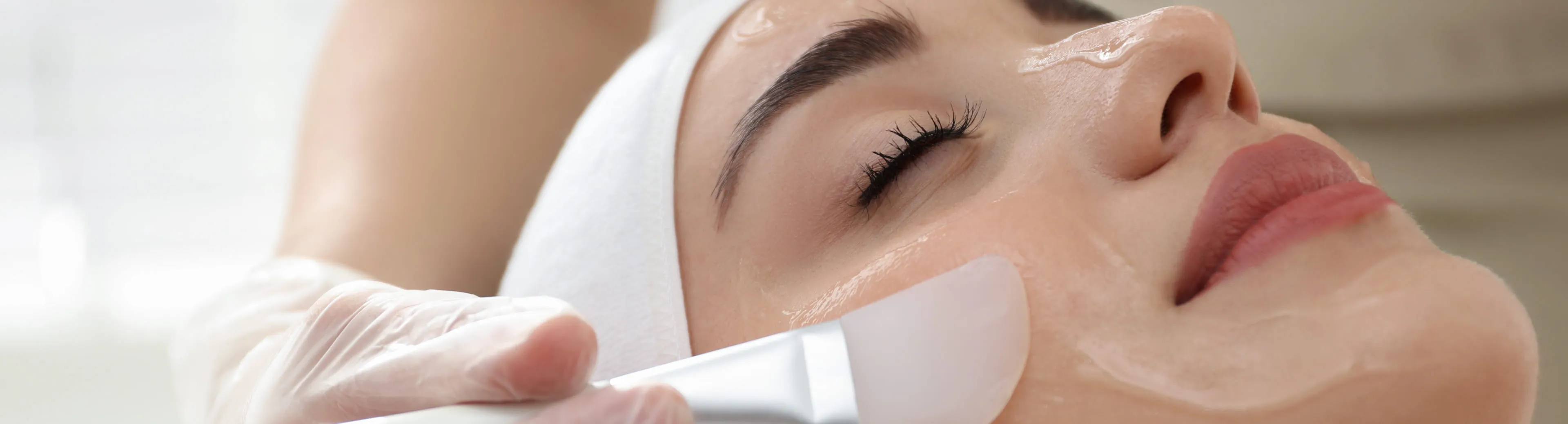 chemical peels banner