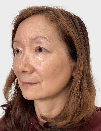 CO₂ Laser Treatment - Before