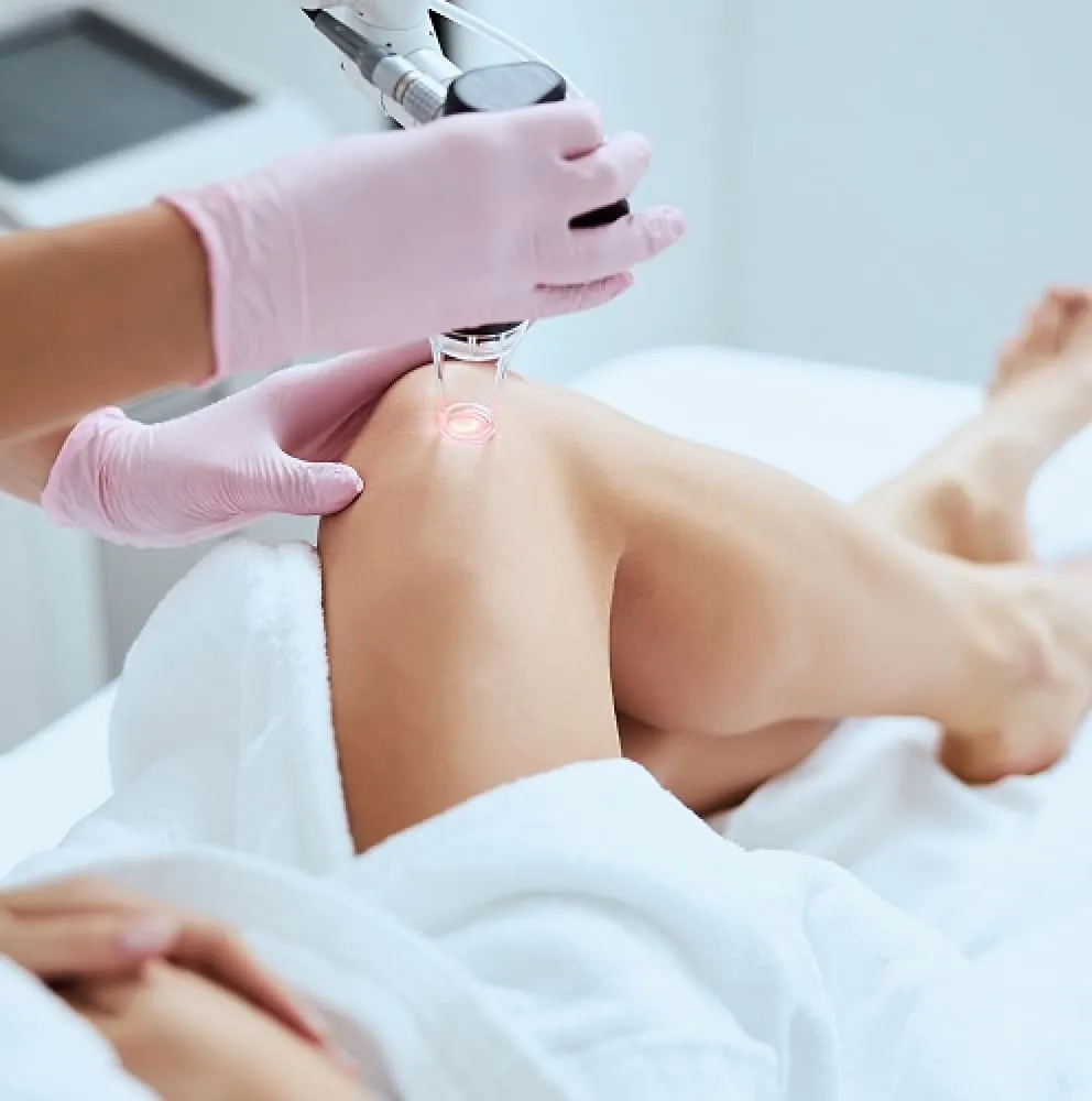 DermaV Vascular Laser