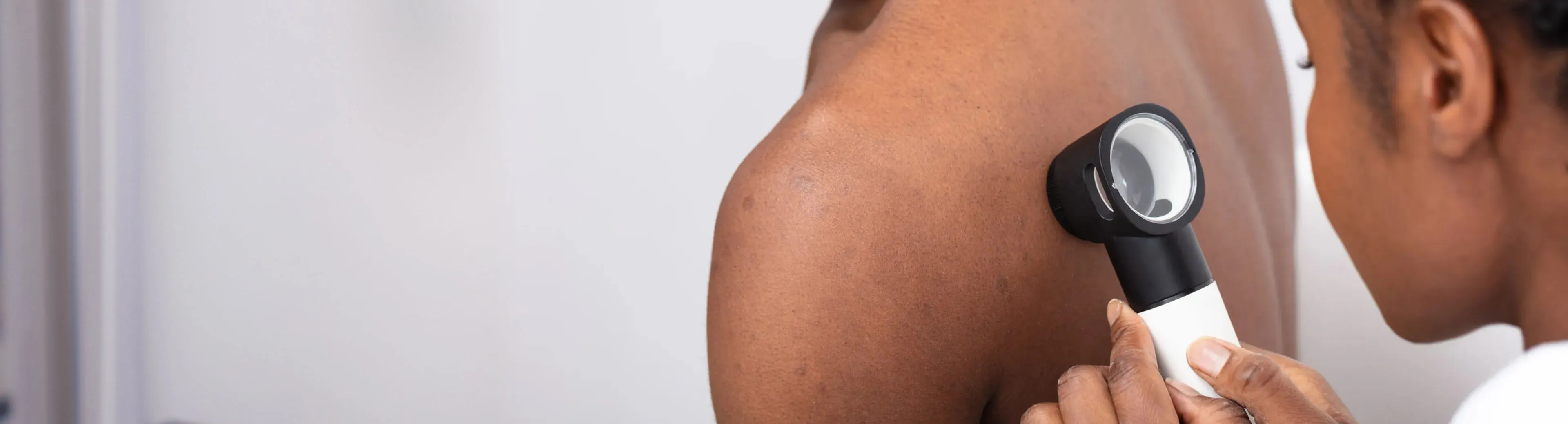 mohs surgery for skin cancer banner