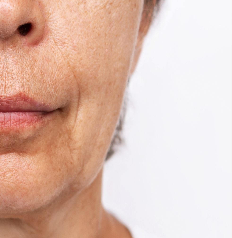 Before treatment